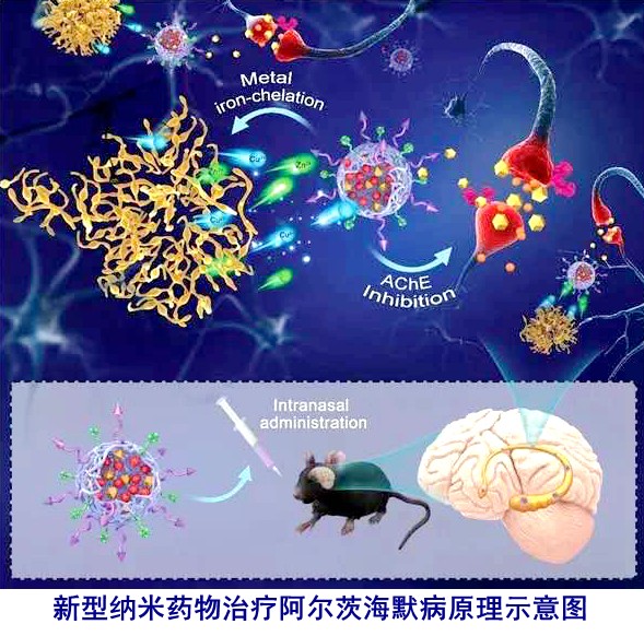 天津大学探索新型纳米药物有望成为治疗阿尔茨海默病新思路 1 天津大学探索新型纳米药物有望成为治疗阿尔茨海默病新思路