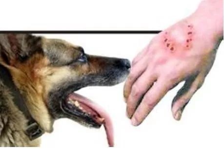 科学家找到抑制狂犬病毒的关键“开关” 1 科学家找到抑制狂犬病毒的关键“开关”