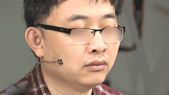研究人员开发可穿戴传感器可帮助ALS患者通过面部交流 2 研究人员开发可穿戴传感器可帮助ALS患者通过面部交流
