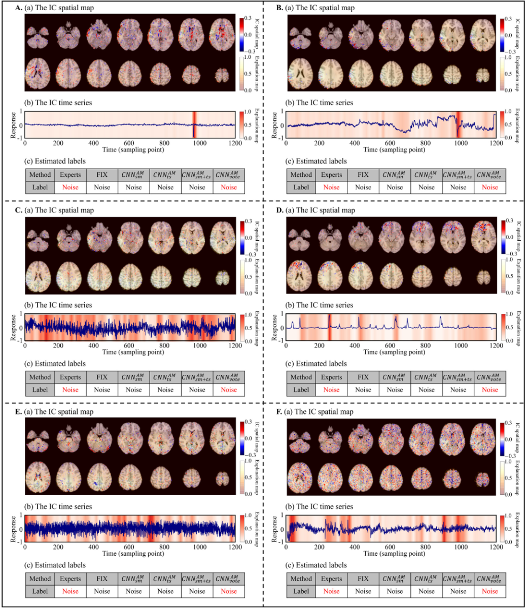 Featured image of post rs-fMRI 深度学习降噪 | 时空特征